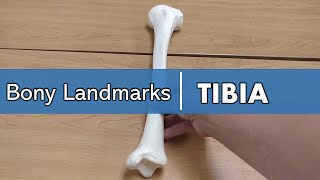 Midbrain  Cross section  Internal structure  Neuroanatomy Tutorial [upl. by Titos]